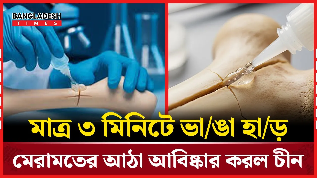 হাড় মেরামতের বিপ্লবী আঠা উদ্ভাবন করল চীন