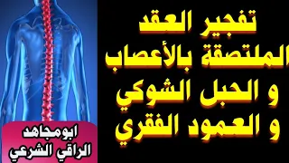رقية قوية فك عقد ملتصقة بالأعصاب و النخاع الشوكي و العمود الفقري اتعبت و امرضت سنين عددا 