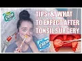 TIPS AND WHAT TO EXPECT AFTER TONSIL SURGERY