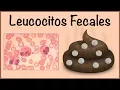 Fecal Leukocytes