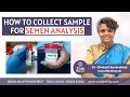 How to collect sample for semen analysis Male infertility Dr Chekuri Suvarchala