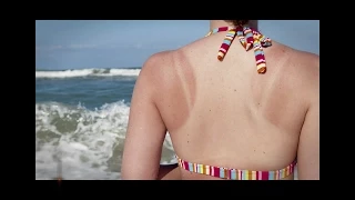  มีสาเหตุอื่นที่ทำให้เกิดมะเร็งผิวหนังนอกเหนือจากแดดหรือไม่ 