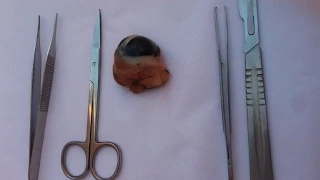 تشريح العين 