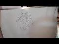 Accidental Whorl