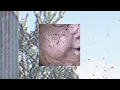 Brek - İlaç Gibi | Official Music Video