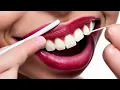 Preparing for a Mouth Swab Drug Test Pass in Advance or Last Minute