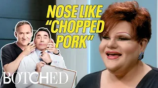 4 Botched Patients Who SHOCKED Doctors Paul Nassif Terry Dubrow Botched E