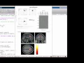 FMRI Slice Analysis Part 1