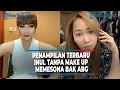 Download Lagu PENAMPILAN TERBARU INUL DARATISTA TANPA MAKE UP DISOROT, MEMESONA BAK ABG @TRIBUNLAMPUNGNEWSVIDEO
