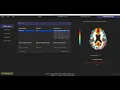 OSU Workshop Part 5 Group-Level Analysis