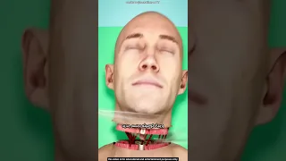 هل يمكن نقل رأس إنسان إلى جسد آخر 