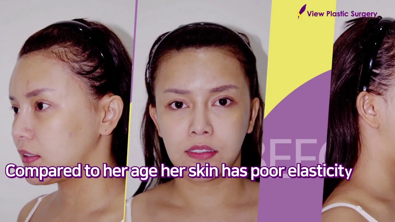 THAI POPULAR BLOGGER'S VIEW PLASTIC SURGERY DIARY WRITTEN BY NOKKY AND ANNIE