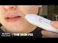 Heated Needle Tool Claims To Remove Skin Tags And Moles At Home The Skin Fix Beauty Insider