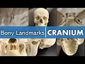 Bony landmarks of the cranium