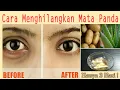 Lagu Ampuh ! Hilangkan Mata Panda / Kantung Mata Selama 3 Hari Dengan Bahan Alami