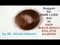Download Lagu Ruqyah for HairLoss due to SiHR, MAGiC, EViL-EYE or iLLNESS [by Khalid Habashi]