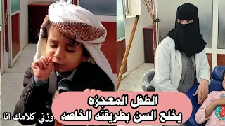 طفل يمني يقلد جده في خلع الاسنان | الدكتوره مندهشه ومصدومه