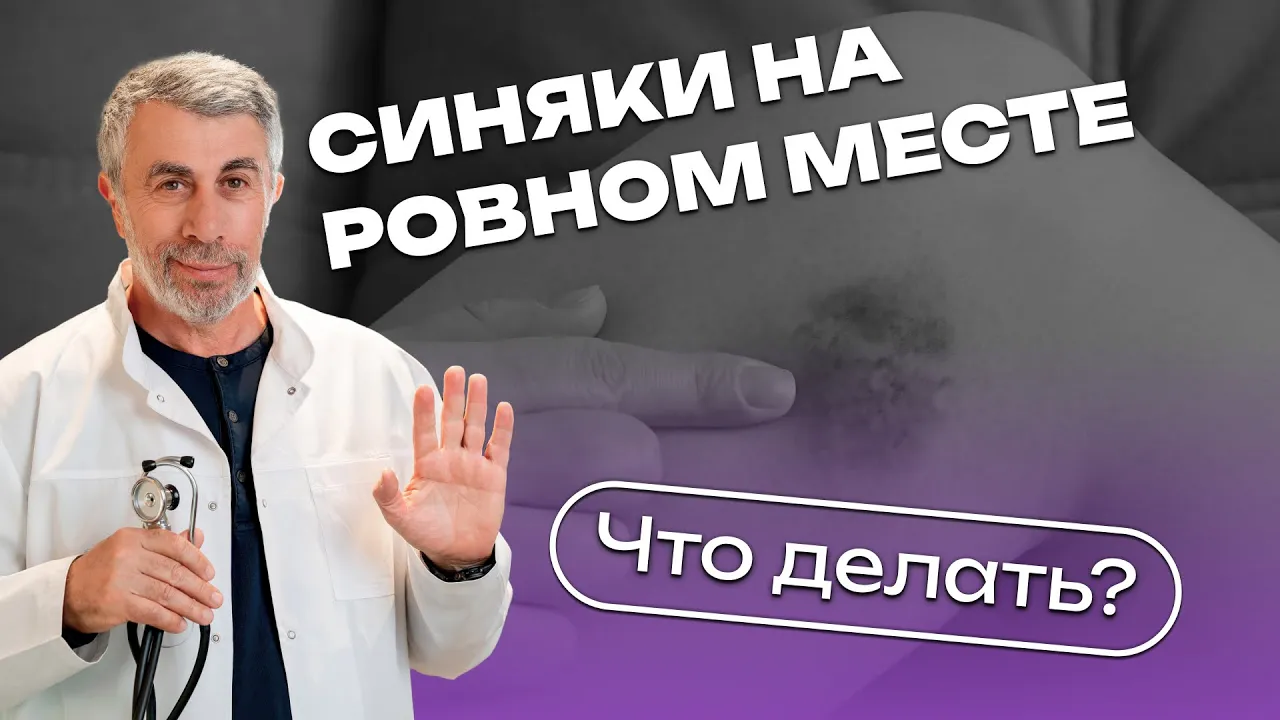 Синяки на ровном месте. Что делать?