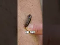 Download Lagu How to REMOVE A LEECH from your skin!