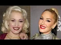 Gwen Stefani s Face Transformation Broken Down By Our Plastic Surgeon