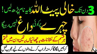 chehre ke daag dhabbe dane hatane ka wazifa remove dark spots on face