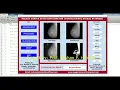 CNN Breast Cancer Identification Using Matlab Project With Source Code Breast Cancer Detection