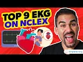 Short Top Tested EKG Rhythms