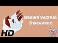 Brown Vaginal Discharge Everything You Need To Know