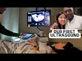 Lagu Onze eerste echo!! Vlog van de fertiliteitskliniek