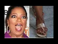 TOP 10 UGLY CELEBRITY FEET PT1 YUCK