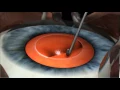 Phacoemulsification Cataract Surgery