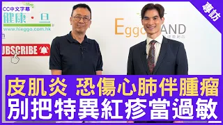 皮肌炎 恐傷心肺伴腫瘤  別把特異紅疹當過敏  #林旭强醫生 皮膚科專科 - 鄭丹瑞《健康旦》(CC中文字幕)