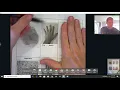 Ulnar vs Radial loops