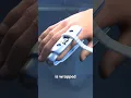 Download Lagu How Finger Splints Work 🤨