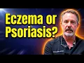 Psoriasis Treatments That Actually Work in 2026