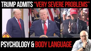 Trump Admits "VERY SEVERE PROBLEMS" Amid More Spasms: Psychology & Body Language