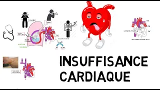 insuffisance cardiaque de A à Z