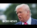 Download Lagu What we know about Trump's newly diagnosed vein condition