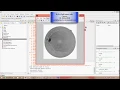 ANALYSIS OF RETINAL BLOOD VESSELS USING IMAGE PROCESSING TECHNIQUES