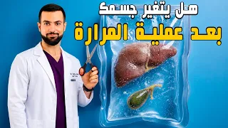 جسمك يخسر آليتين بعد إزالة المرارة! سبب ألم البطن والإسهال والانتفاخ الغازات والإعياء