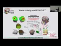 Dynamic Brain Mapping and Brain-Computer Interface
