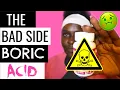 Boric Acid Suppositories Side Effects MUST SEE BEFORE USING