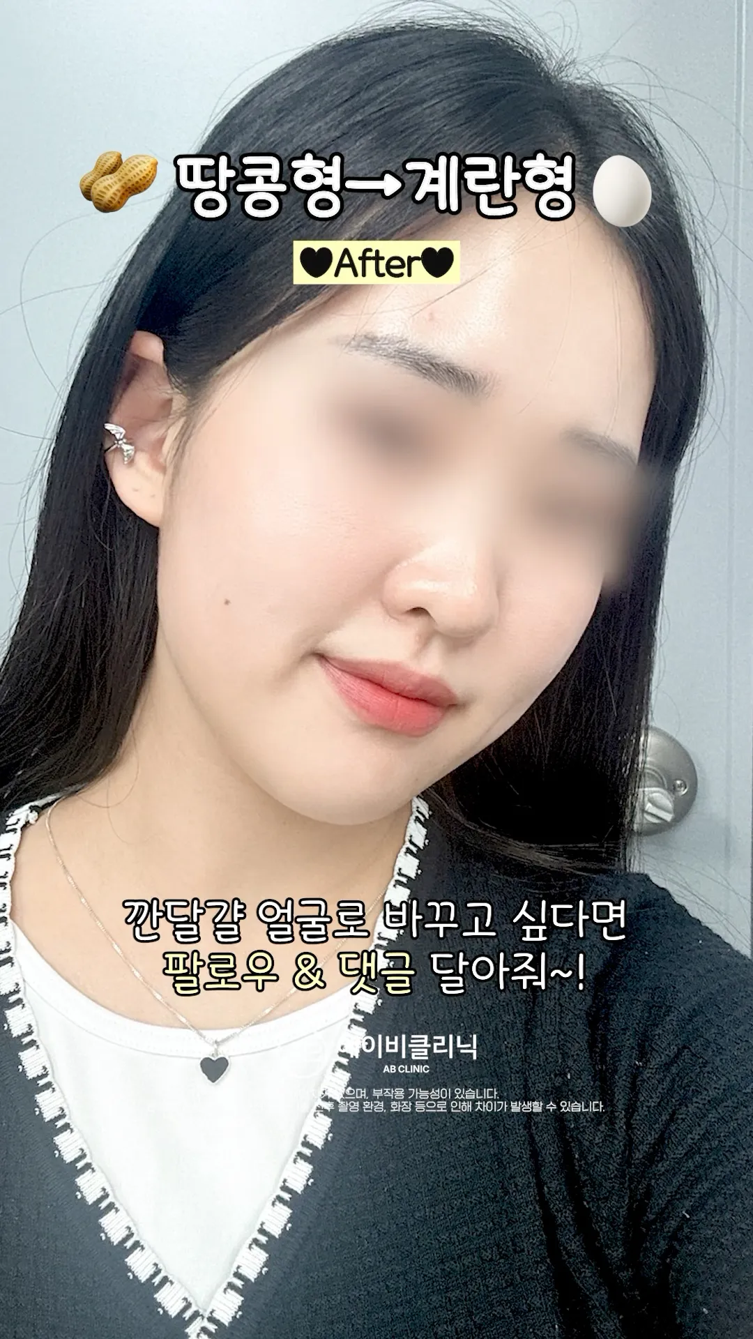 계란형 얼굴 만드는 비법 🩷