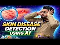 Skin Disease Detection Using AI Deep Learning Project