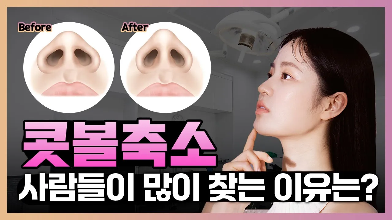 콧볼축소 수술이 인기가 많은 이유