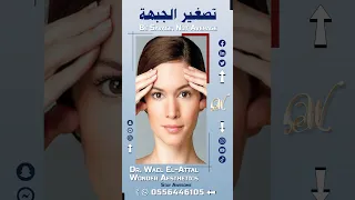 تصغير الجبهة 