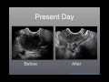Emergency Ultrasound Past Present Future
