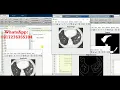 Lung Cancer Detection Using Matlab Project Source Code