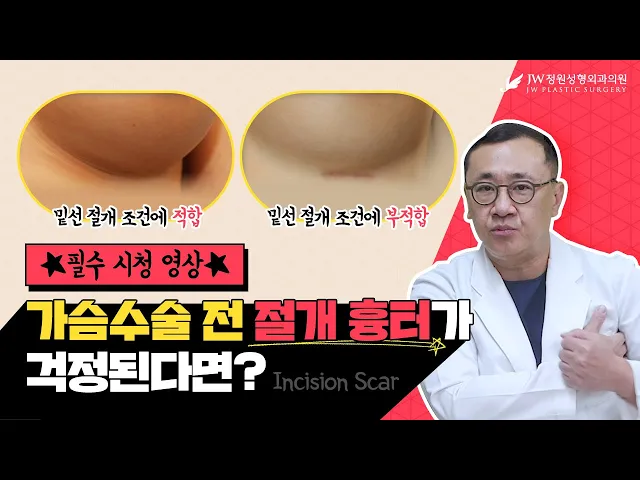 가슴성형 절개 흉터 안 남기려면 ★필.수.시.청★ 어디서도 들을 수 없었던 『설철환원장의 절개 부위별 특징』