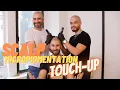Download Lagu Getting Scalp Micropigmentation TOUCH UP's